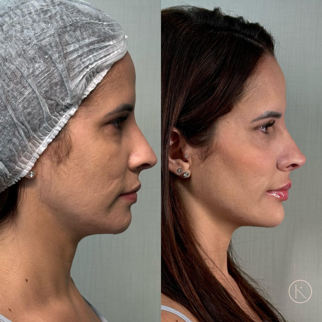 Procedimento-15